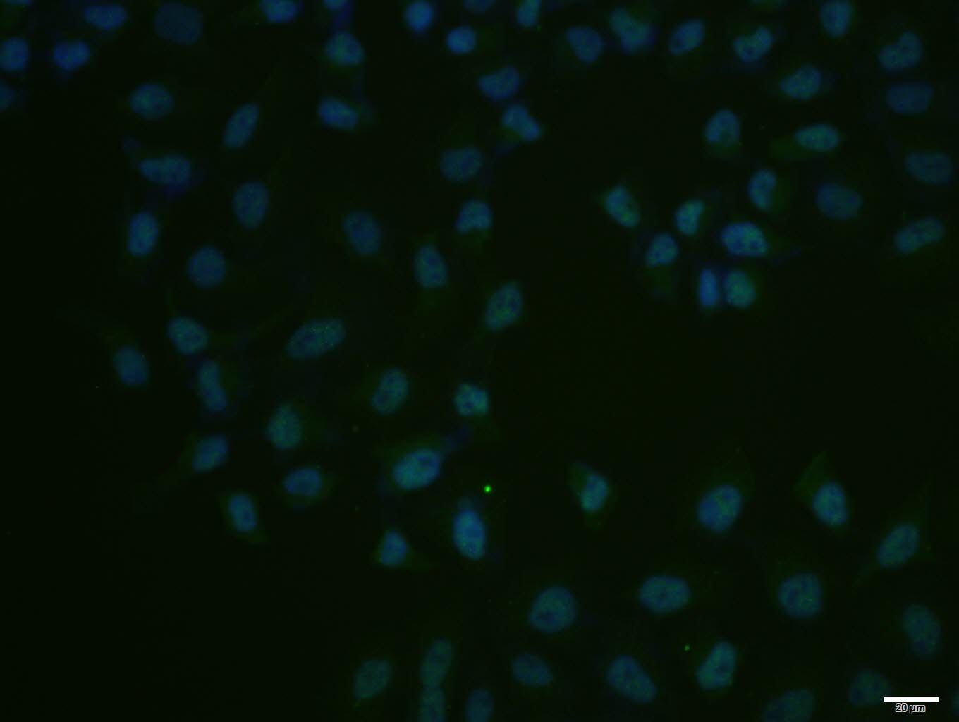 Hela cell; 4% Paraformaldehyde-fixed; Triton X-100 at room temperature for 20 min; Blocking buffer (normal goat serum, C-0005) at 37°C for 20 min; Antibody incubation with (Cdc25C) polyclonal Antibody, Unconjugated (bs-10579R) 1:100, 90 minutes at 37°C; followed by a conjugated Goat Anti-Rabbit IgG antibody at 37°C for 90 minutes, DAPI (blue, C02-04002) was used to stain the cell nuclei.