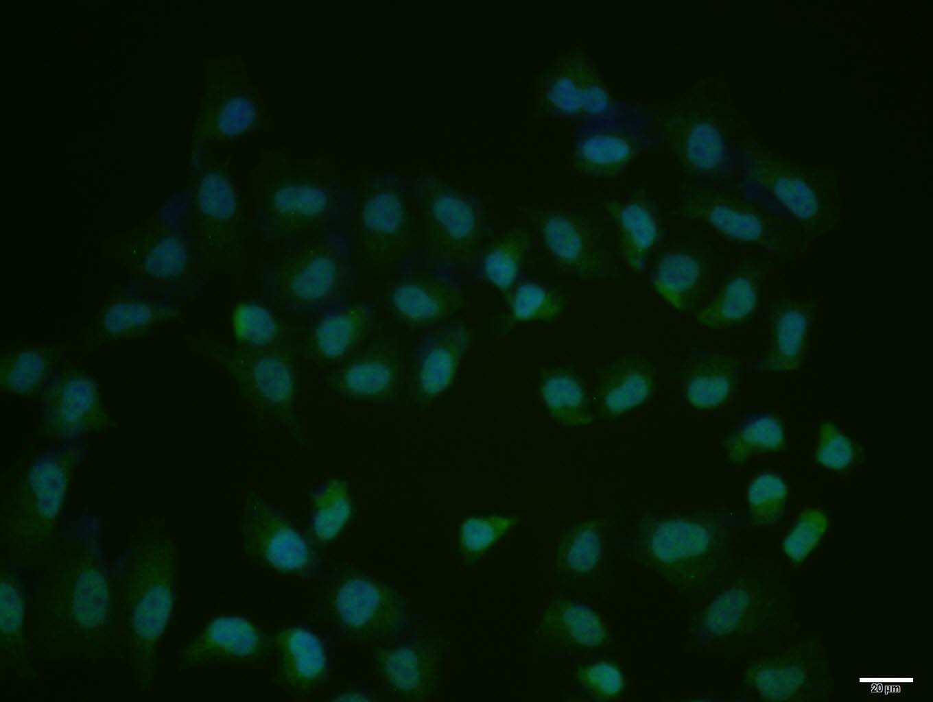 Hela cell; 4% Paraformaldehyde-fixed; Triton X-100 at room temperature for 20 min; Blocking buffer (normal goat serum, C-0005) at 37°C for 20 min; Antibody incubation with (Phospho-cdc25C (Thr48)) polyclonal Antibody, Unconjugated (bs-3482R) 1:100, 90 minutes at 37°C; followed by a conjugated Goat Anti-Rabbit IgG antibody at 37°C for 90 minutes, DAPI (blue, C02-04002) was used to stain the cell nuclei.