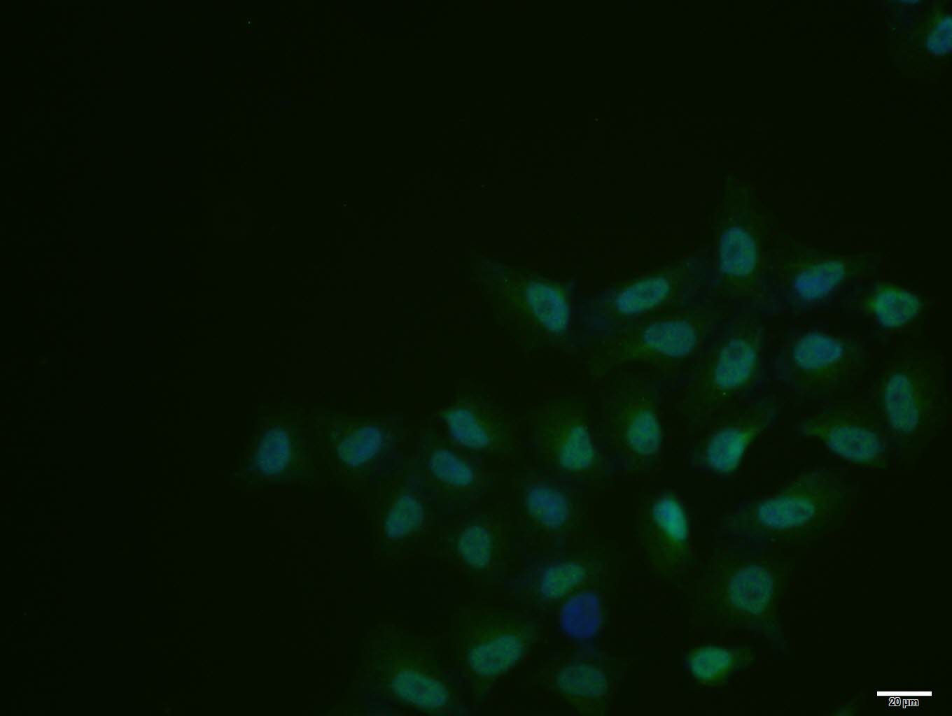 Hela cell; 4% Paraformaldehyde-fixed; Triton X-100 at room temperature for 20 min; Blocking buffer (normal goat serum, C-0005) at 37°C for 20 min; Antibody incubation with (phospho-CDK7 (Thr170)) polyclonal Antibody, Unconjugated (bs-10997R) 1:100, 90 minutes at 37°C; followed by a conjugated Goat Anti-Rabbit IgG antibody at 37°C for 90 minutes, DAPI (blue, C02-04002) was used to stain the cell nuclei.