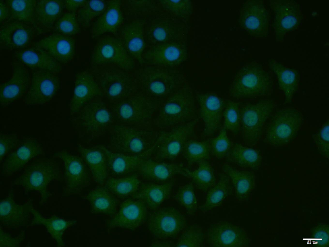 HepG2 cell; 4% Paraformaldehyde-fixed; Triton X-100 at room temperature for 20 min; Blocking buffer (normal goat serum, C-0005) at 37°C for 20 min; Antibody incubation with (phospho-E2F1 (Ser337)) polyclonal Antibody, Unconjugated (bs-5305R) 1:100, 90 minutes at 37°C; followed by a conjugated Goat Anti-Rabbit IgG antibody at 37°C for 90 minutes, DAPI (blue, C02-04002) was used to stain the cell nuclei.