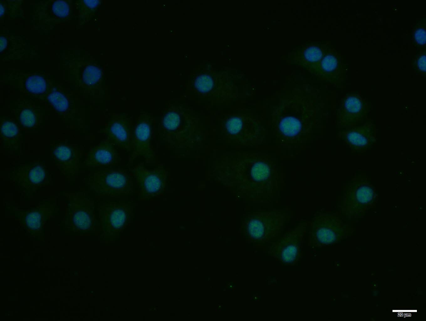 HepG2 cell; 4% Paraformaldehyde-fixed; Triton X-100 at room temperature for 20 min; Blocking buffer (normal goat serum, C-0005) at 37°C for 20 min; Antibody incubation with (E2F1) polyclonal Antibody, Unconjugated (bs-23185R) 1:100, 90 minutes at 37°C; followed by a conjugated Goat Anti-Rabbit IgG antibody at 37°C for 90 minutes, DAPI (blue, C02-04002) was used to stain the cell nuclei.