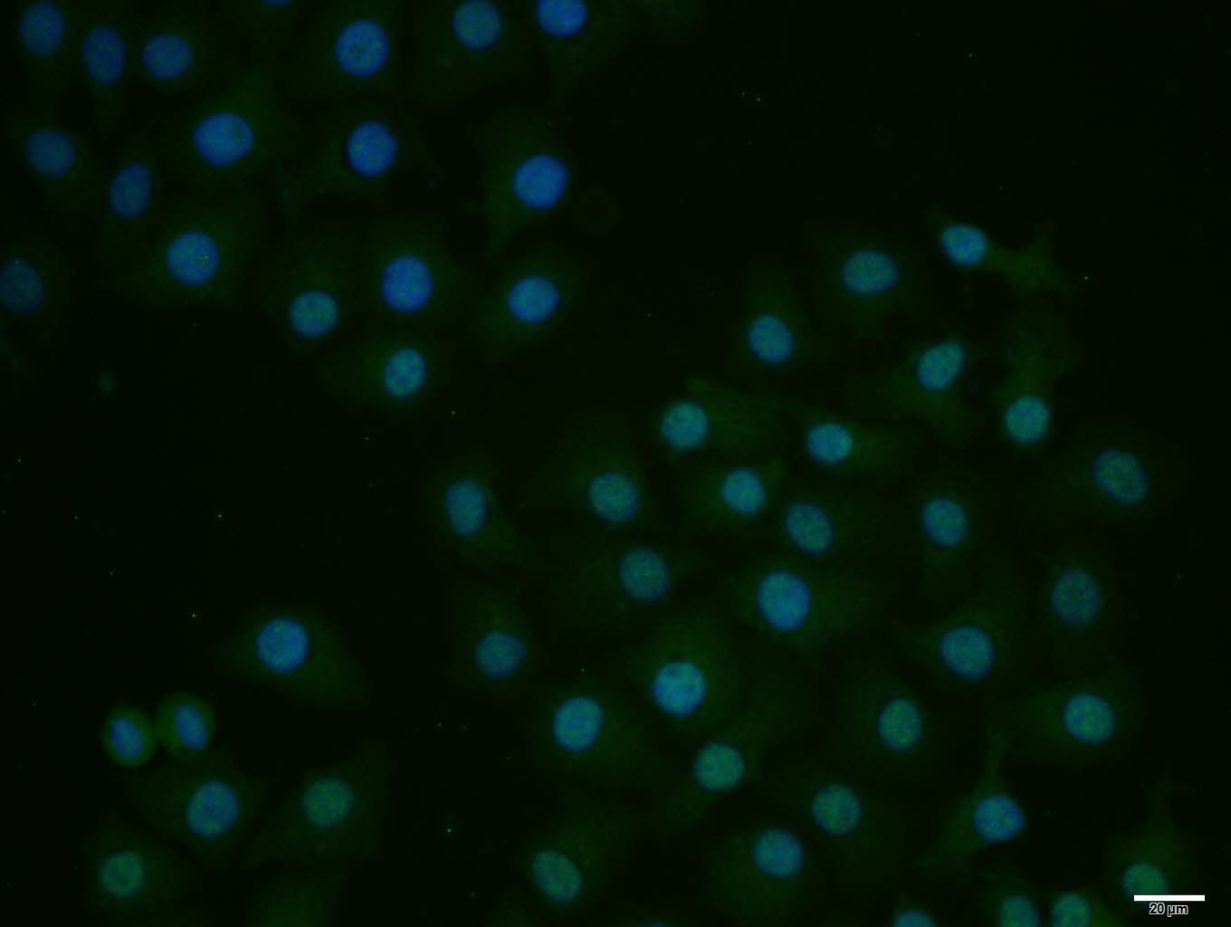 HepG2 cell; 4% Paraformaldehyde-fixed; Triton X-100 at room temperature for 20 min; Blocking buffer (normal goat serum, C-0005) at 37°C for 20 min; Antibody incubation with (E2F1) polyclonal Antibody, Unconjugated (bs-23185R) 1:100, 90 minutes at 37°C; followed by a conjugated Goat Anti-Rabbit IgG antibody at 37°C for 90 minutes, DAPI (blue, C02-04002) was used to stain the cell nuclei.