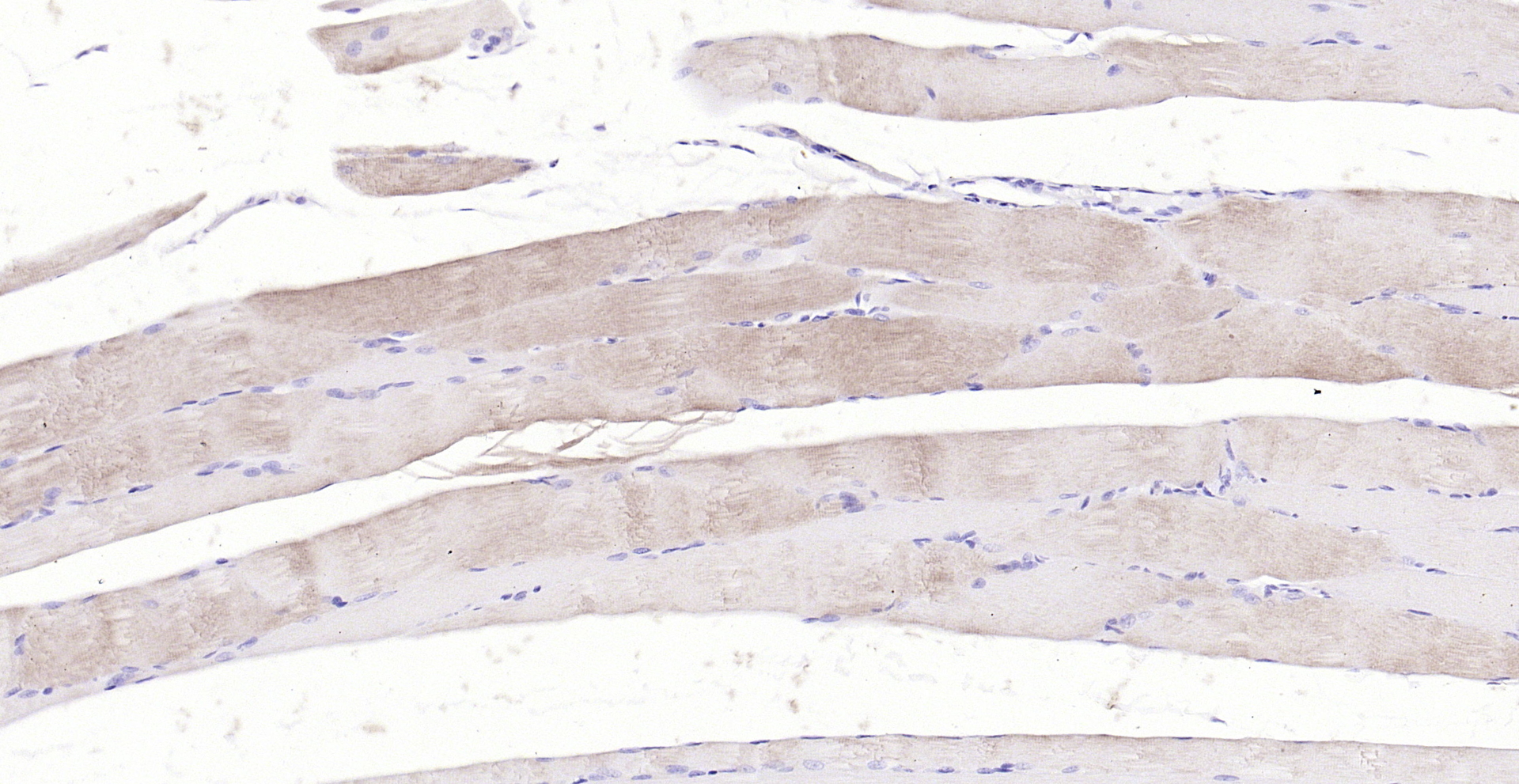 Paraformaldehyde-fixed, paraffin embedded (rat skeletal muscle); Antigen retrieval by boiling in sodium citrate buffer (pH6.0) for 15min; Block endogenous peroxidase by 3% hydrogen peroxide for 20 minutes; Blocking buffer (normal goat serum) at 37°C for 30min; Antibody incubation with (Actin) Polyclonal Antibody, Unconjugated (bs-10966R) at 1:200 overnight at 4°C, followed by operating according to SP Kit(Rabbit) (sp-0023) instructionsand DAB staining.