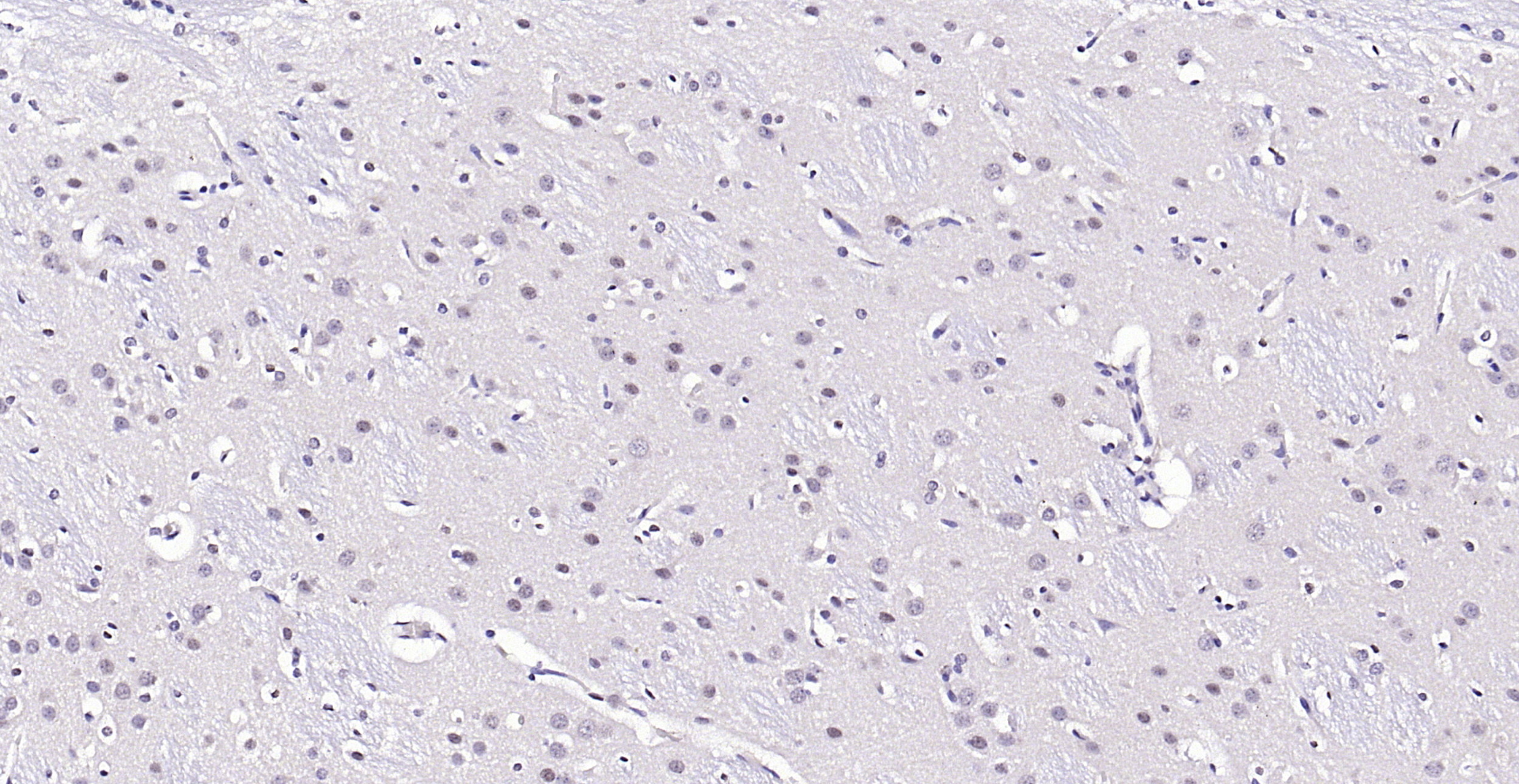 Paraformaldehyde-fixed, paraffin embedded (rat brain); Antigen retrieval by boiling in sodium citrate buffer (pH6.0) for 15min; Block endogenous peroxidase by 3% hydrogen peroxide for 20 minutes; Blocking buffer (normal goat serum) at 37°C for 30min; Antibody incubation with (AKT (Ser473)(9H11) Monoclonal Antibody, Unconjugated (bsm-33281M) at 1:200 overnight at 4°C, followed by operating according to SP Kit(Mouse)(sp-0024) instructionsand DAB staining.