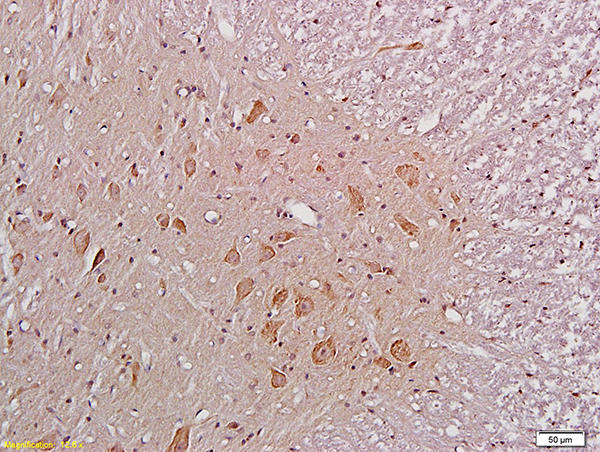 Formalin-fixed and paraffin embedded rat spinal cord labeled with Anti-NR1\/NMDAR1 Polyclonal Antibody, Unconjugated (bs-2175R)  at 1:200 followed by conjugation to the secondary antibody and DAB staining