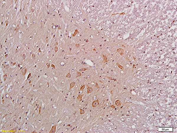 Formalin-fixed and paraffin embedded rat spinal cord labeled with Anti-NR1/NMDAR1 Polyclonal Antibody, Unconjugated (bs-2175R) at 1:200 followed by conjugation to the secondary antibody and DAB staining