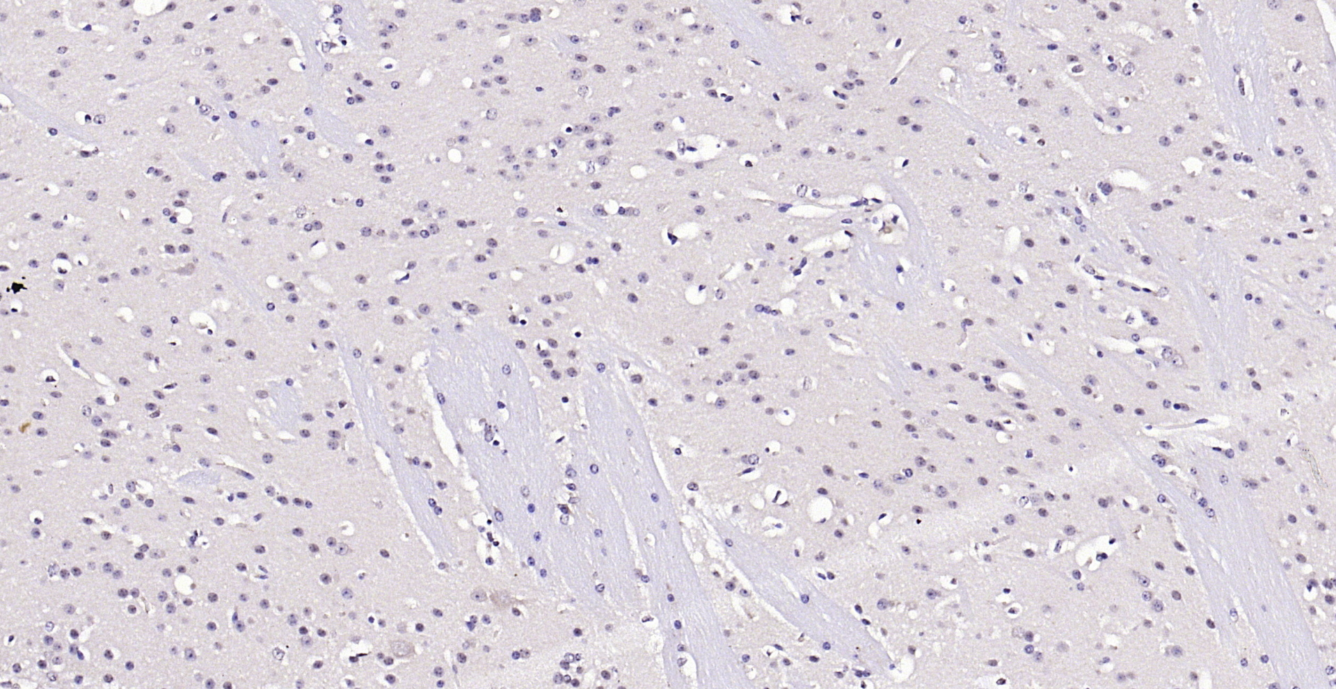 Paraformaldehyde-fixed, paraffin embedded (mouse brain); Antigen retrieval by boiling in sodium citrate buffer (pH6.0) for 15min; Block endogenous peroxidase by 3% hydrogen peroxide for 20 minutes; Blocking buffer (normal goat serum) at 37°C for 30min; Antibody incubation with (AKT (Ser473)(9H11) Monoclonal Antibody, Unconjugated (bsm-33281M) at 1:200 overnight at 4°C, followed by operating according to SP Kit(Mouse)(sp-0024) instructionsand DAB staining.