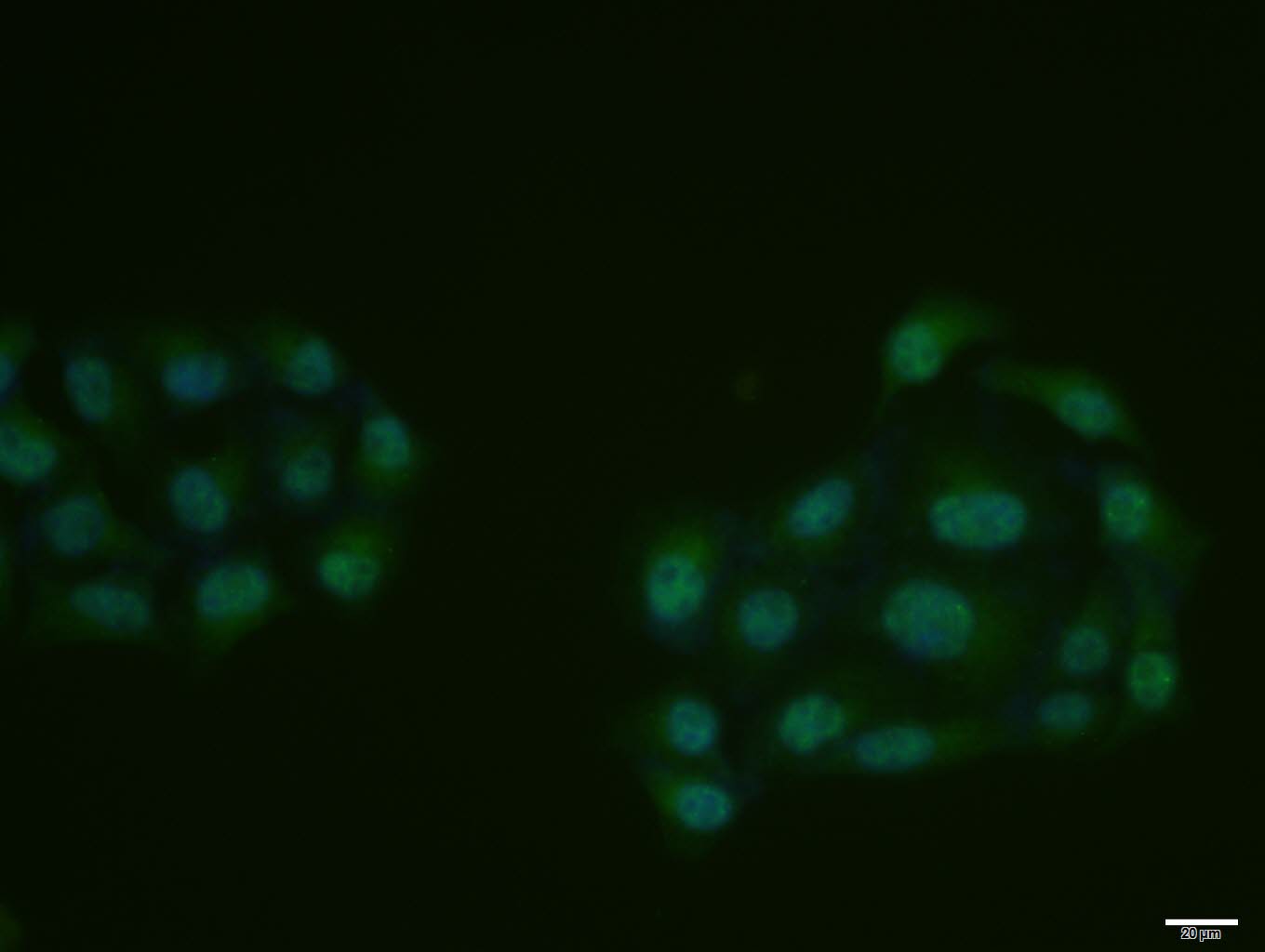 Hela cell; 4% Paraformaldehyde-fixed; Triton X-100 at room temperature for 20 min; Blocking buffer (normal goat serum, C-0005) at 37°C for 20 min; Antibody incubation with (phospho-CDK7 (Thr170)) polyclonal Antibody, Unconjugated (bs-10997R) 1:100, 90 minutes at 37°C; followed by a conjugated Goat Anti-Rabbit IgG antibody at 37°C for 90 minutes, DAPI (blue, C02-04002) was used to stain the cell nuclei.