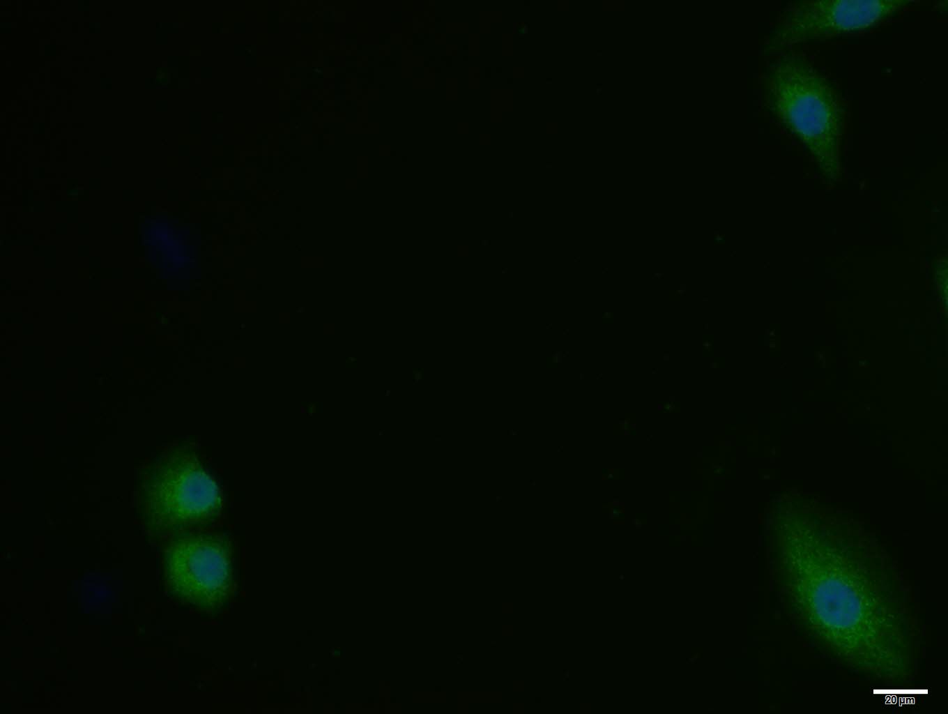 MCF-7 cell; 4% Paraformaldehyde-fixed; Triton X-100 at room temperature for 20 min; Blocking buffer (normal goat serum, C-0005) at 37°C for 20 min; Antibody incubation with (Bid) polyclonal Antibody, Unconjugated (bs-1153R) 1:100, 90 minutes at 37°C; followed by a conjugated Goat Anti-Rabbit IgG antibody at 37°C for 90 minutes, DAPI (blue, C02-04002) was used to stain the cell nuclei.