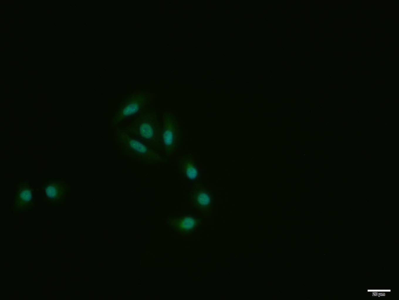 MCF-7 cell; 4% Paraformaldehyde-fixed; Triton X-100 at room temperature for 20 min; Blocking buffer (normal goat serum, C-0005) at 37°C for 20 min; Antibody incubation with (HES1) polyclonal Antibody, Unconjugated (bs-2972R) 1:100, 90 minutes at 37°C; followed by a conjugated Goat Anti-Rabbit IgG antibody at 37°C for 90 minutes, DAPI (blue, C02-04002) was used to stain the cell nuclei.