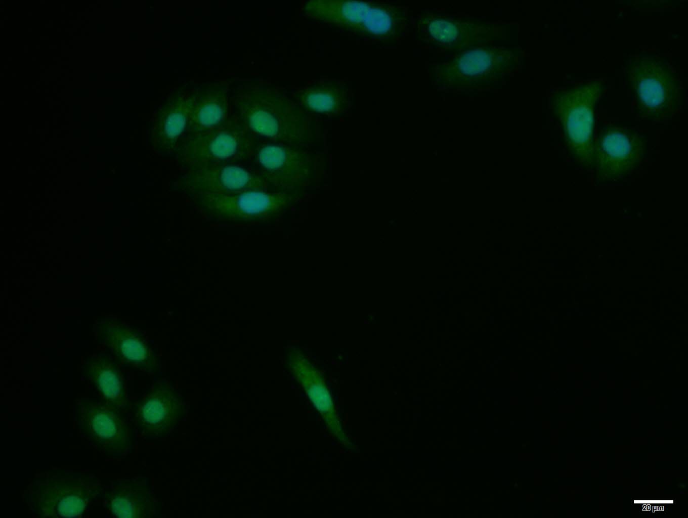 MCF-7 cell; 4% Paraformaldehyde-fixed; Triton X-100 at room temperature for 20 min; Blocking buffer (normal goat serum, C-0005) at 37°C for 20 min; Antibody incubation with (HES1) polyclonal Antibody, Unconjugated (bs-2972R) 1:100, 90 minutes at 37°C; followed by a conjugated Goat Anti-Rabbit IgG antibody at 37°C for 90 minutes, DAPI (blue, C02-04002) was used to stain the cell nuclei.
