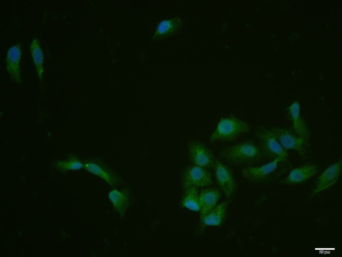 MCF-7 cell; 4% Paraformaldehyde-fixed; Triton X-100 at room temperature for 20 min; Blocking buffer (normal goat serum, C-0005) at 37°C for 20 min; Antibody incubation with (Fbxw7) polyclonal Antibody, Unconjugated (bs-8394R) 1:100, 90 minutes at 37°C; followed by a conjugated Goat Anti-Rabbit IgG antibody at 37°C for 90 minutes, DAPI (blue, C02-04002) was used to stain the cell nuclei. MCF-7 cell; 4% Paraformaldehyde-fixed; Triton X-100 at room temperature for 20 min; Blocking buffer (normal goat serum, C-0005) at 37°C for 20 min; Antibody incubation with (Fbxw7) polyclonal Antibody, Unconjugated (bs-8394R) 1:100, 90 minutes at 37°C; followed by a conjugated Goat Anti-Rabbit IgG antibody at 37°C for 90 minutes, DAPI (blue, C02-04002) was used to stain the cell nuclei.