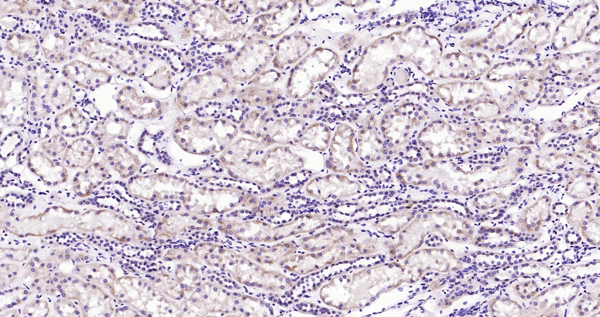 Paraformaldehyde-fixed, paraffin embedded (Human kidney); Antigen retrieval by boiling in sodium citrate buffer (pH6.0) for 15min; Block endogenous peroxidase by 3% hydrogen peroxide for 20 minutes; Blocking buffer (normal goat serum) at 37°C for 30min; Antibody incubation with (WNT10B) Polyclonal Antibody, Unconjugated (bs-3662R) at 1:200 overnight at 4°C, followed by operating according to SP Kit(Rabbit) (sp-0023) instructionsand DAB staining.