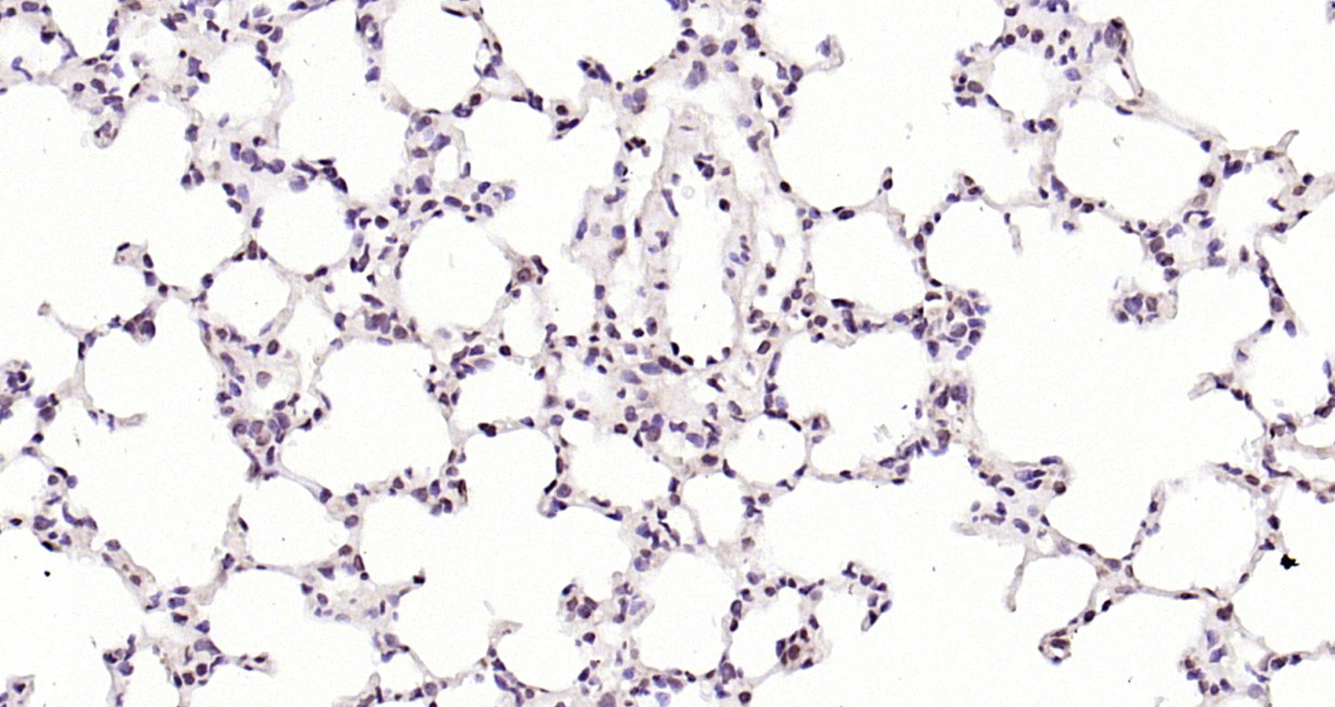 Paraformaldehyde-fixed, paraffin embedded (rat lung); Antigen retrieval by boiling in sodium citrate buffer (pH6.0) for 15min; Block endogenous peroxidase by 3% hydrogen peroxide for 20 minutes; Blocking buffer (normal goat serum) at 37°C for 30min; Antibody incubation with (RNA polymerase II) Polyclonal Antibody, Unconjugated (bs-6972R) at 1:200 overnight at 4°C, followed by operating according to SP Kit(Rabbit) (sp-0023) instructionsand DAB staining.