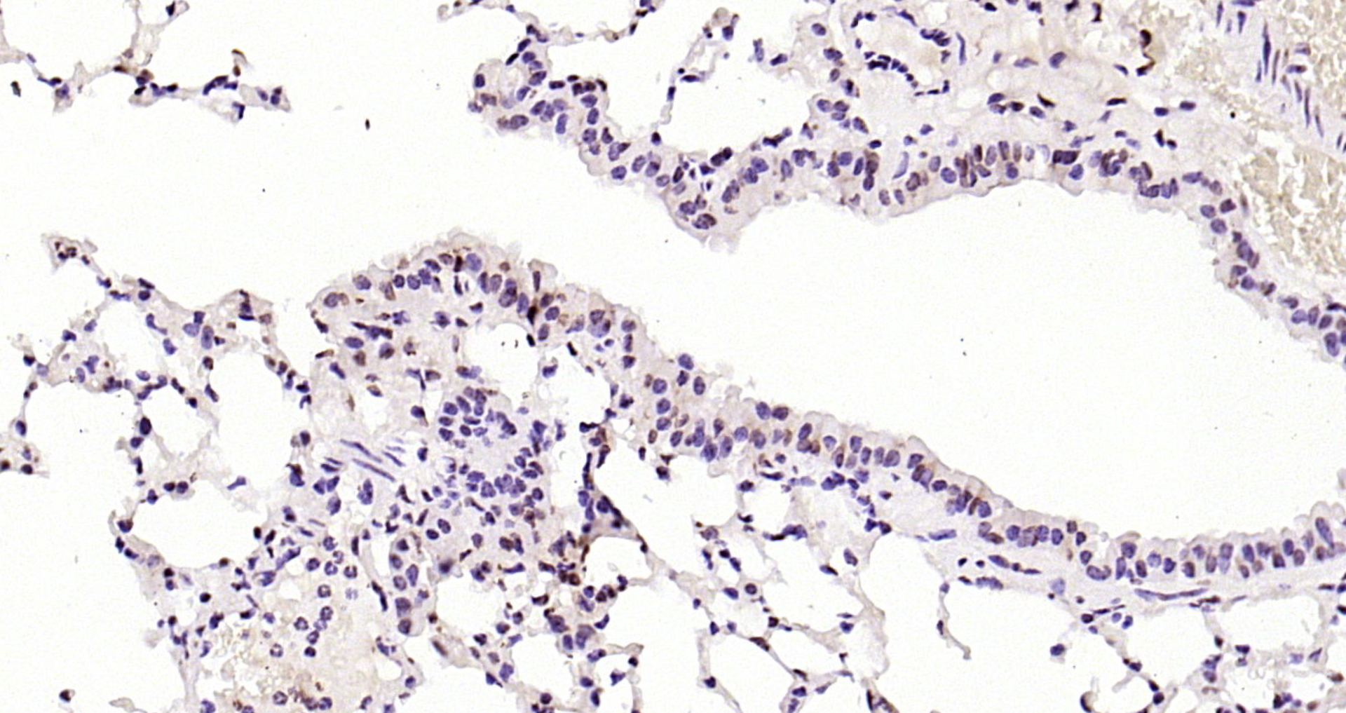 Paraformaldehyde-fixed, paraffin embedded (mouse lung); Antigen retrieval by boiling in sodium citrate buffer (pH6.0) for 15min; Block endogenous peroxidase by 3% hydrogen peroxide for 20 minutes; Blocking buffer (normal goat serum) at 37°C for 30min; Antibody incubation with (RNA polymerase II) Polyclonal Antibody, Unconjugated (bs-6972R) at 1:200 overnight at 4°C, followed by operating according to SP Kit(Rabbit) (sp-0023) instructionsand DAB staining.