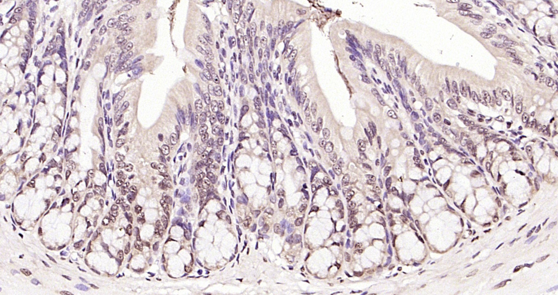 Paraformaldehyde-fixed, paraffin embedded (rat colon); Antigen retrieval by boiling in sodium citrate buffer (pH6.0) for 15min; Block endogenous peroxidase by 3% hydrogen peroxide for 20 minutes; Blocking buffer (normal goat serum) at 37°C for 30min; Antibody incubation with (RNA polymerase II) Polyclonal Antibody, Unconjugated (bs-6972R) at 1:200 overnight at 4°C, followed by operating according to SP Kit(Rabbit) (sp-0023) instructionsand DAB staining.