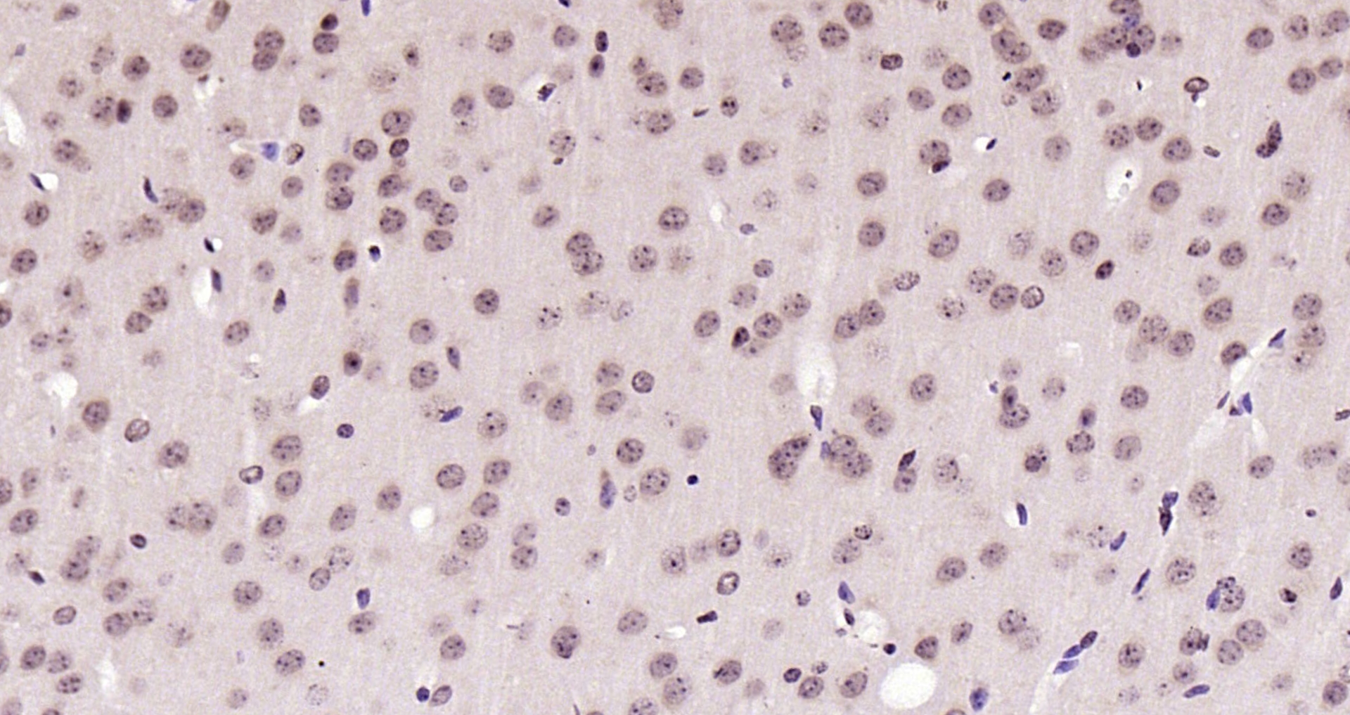 Paraformaldehyde-fixed, paraffin embedded (rat brain); Antigen retrieval by boiling in sodium citrate buffer (pH6.0) for 15min; Block endogenous peroxidase by 3% hydrogen peroxide for 20 minutes; Blocking buffer (normal goat serum) at 37°C for 30min; Antibody incubation with (RNA polymerase II) Polyclonal Antibody, Unconjugated (bs-6972R) at 1:200 overnight at 4°C, followed by operating according to SP Kit(Rabbit) (sp-0023) instructionsand DAB staining.