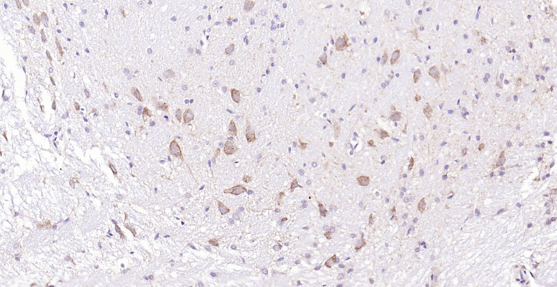 Paraformaldehyde-fixed, paraffin embedded (rat cerebellum); Antigen retrieval by boiling in sodium citrate buffer (pH6.0) for 15min; Block endogenous peroxidase by 3% hydrogen peroxide for 20 minutes; Blocking buffer (normal goat serum) at 37°C for 30min; Antibody incubation with (BDNF) Polyclonal Antibody, Unconjugated (bs-4989R) at 1:200 overnight at 4°C, followed by operating according to SP Kit(Rabbit) (sp-0023) instructionsand DAB staining.