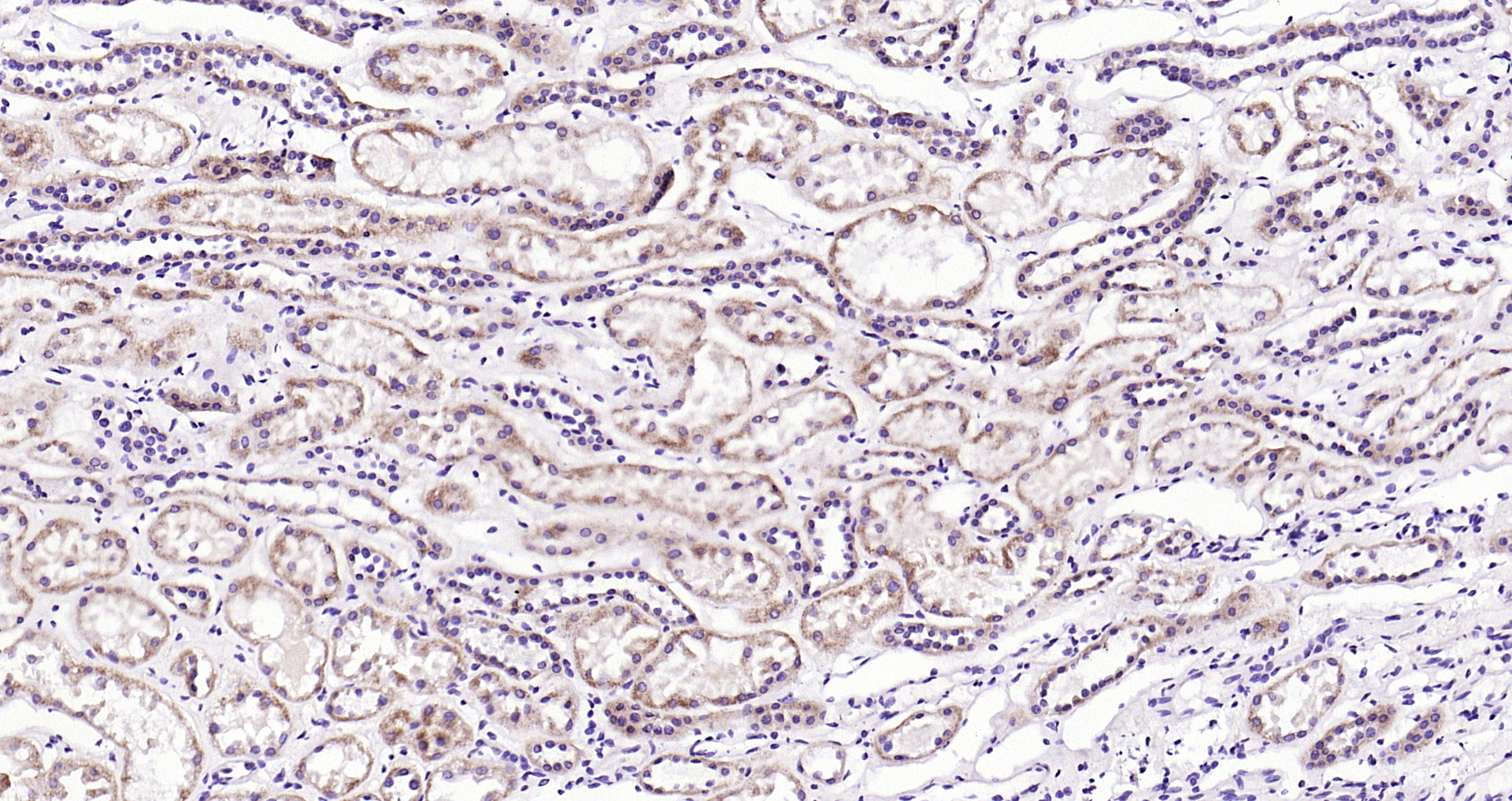 Paraformaldehyde-fixed, paraffin embedded (Human kidney); Antigen retrieval by boiling in sodium citrate buffer (pH6.0) for 15min; Block endogenous peroxidase by 3% hydrogen peroxide for 20 minutes; Blocking buffer (normal goat serum) at 37°C for 30min; Antibody incubation with (IDH1) Polyclonal Antibody, Unconjugated (bs-9634R) at 1:200 overnight at 4°C, followed by operating according to SP Kit(Rabbit) (sp-0023) instructionsand DAB staining.
