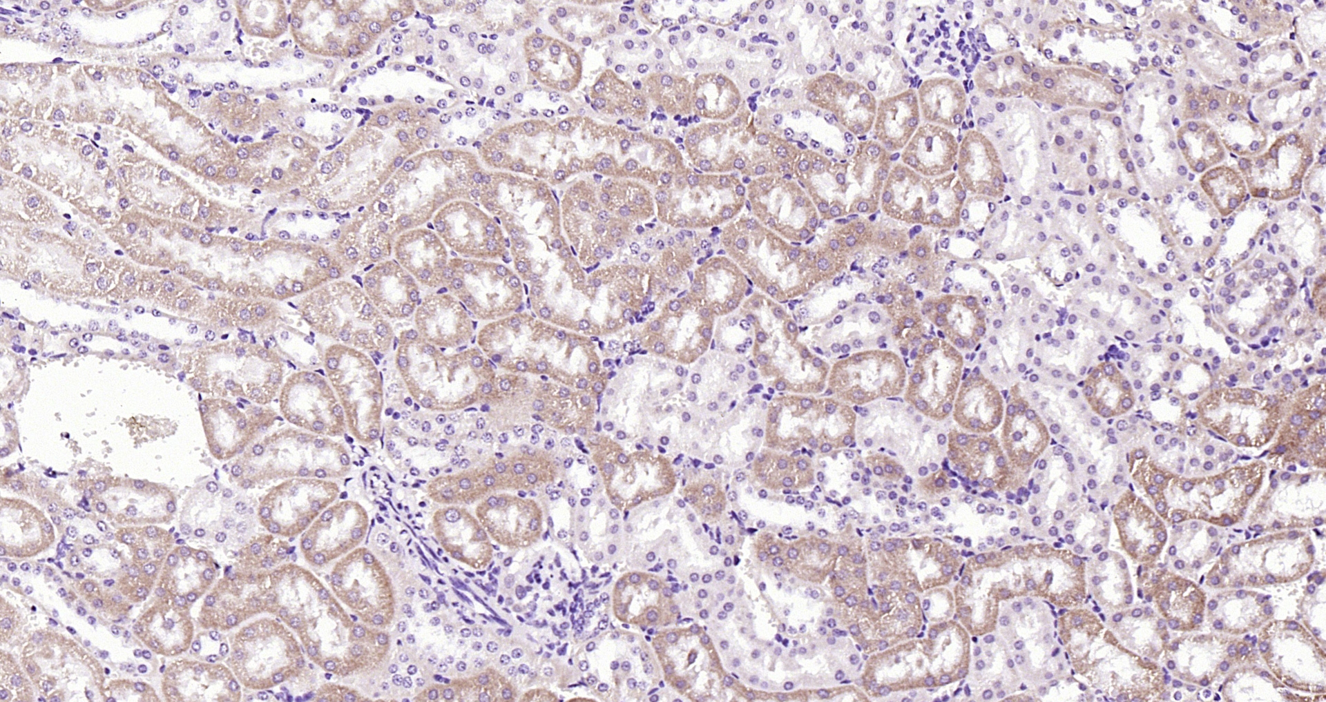 Paraformaldehyde-fixed, paraffin embedded (mouse kidney); Antigen retrieval by boiling in sodium citrate buffer (pH6.0) for 15min; Block endogenous peroxidase by 3% hydrogen peroxide for 20 minutes; Blocking buffer (normal goat serum) at 37°C for 30min; Antibody incubation with (IDH1) Polyclonal Antibody, Unconjugated (bs-9634R) at 1:200 overnight at 4°C, followed by operating according to SP Kit(Rabbit) (sp-0023) instructionsand DAB staining.