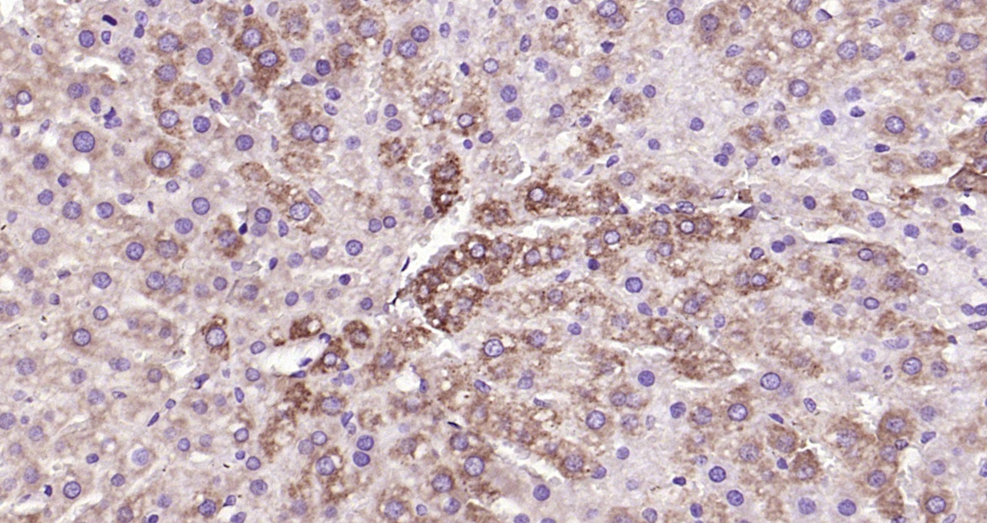 Paraformaldehyde-fixed, paraffin embedded (rat liver); Antigen retrieval by boiling in sodium citrate buffer (pH6.0) for 15min; Block endogenous peroxidase by 3% hydrogen peroxide for 20 minutes; Blocking buffer (normal goat serum) at 37°C for 30min; Antibody incubation with (Active Caspase 3) Monoclonal Antibody, Unconjugated (bsm-33199M) at 1:200 overnight at 4°C, followed by operating according to SP Kit(Mouse)(sp-0024) instructionsand DAB staining.