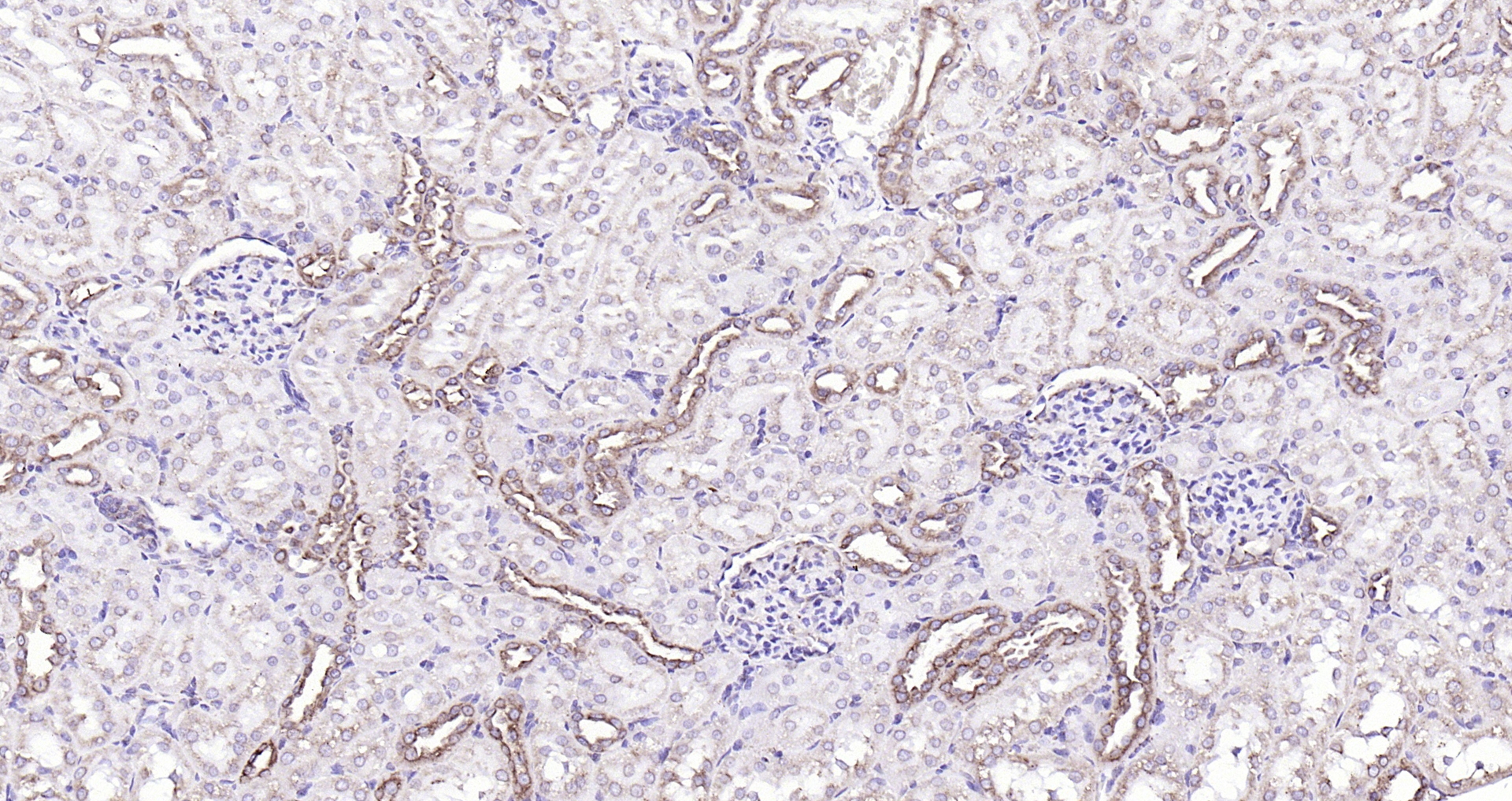 Paraformaldehyde-fixed, paraffin embedded （rat kidney); Antigen retrieval by boiling in sodium citrate buffer (pH6.0) for 15min; Block endogenous peroxidase by 3% hydrogen peroxide for 20 minutes; Blocking buffer (normal goat serum) at 37°C for 30min; Antibody incubation with (Calreticulin(3D1)) Monoclonal Antibody, Unconjugated (bsm-52436R) at 1:200 overnight at 4°C, followed by operating according to SP Kit(Rabbit) (sp-0023) instructionsand DAB staining.