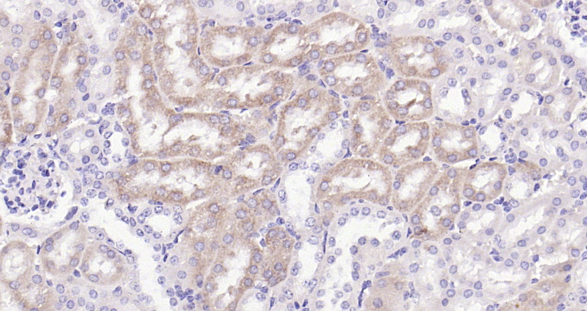 Paraformaldehyde-fixed, paraffin embedded (mouse kidney); Antigen retrieval by boiling in sodium citrate buffer (pH6.0) for 15min; Block endogenous peroxidase by 3% hydrogen peroxide for 20 minutes; Blocking buffer (normal goat serum) at 37°C for 30min; Antibody incubation with (BCAT1) Polyclonal Antibody, Unconjugated (bs-6613R ) at 1:200 overnight at 4°C, followed by operating according to SP Kit(Rabbit) (sp-0023) instructionsand DAB staining.