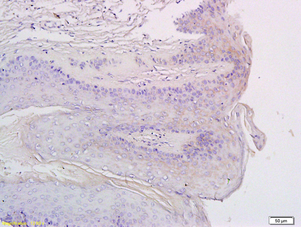 Formalin-fixed and paraffin embedded rat exfoliated cells labeled with Anti-CXCR3 Polyclonal Antibody, Unconjugated (bs-2209R) at 1:200 followed by conjugation to the secondary antibody and DAB staining