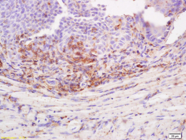 Formalin-fixed and paraffin embedded rat tongue labeled with Anti-Desmoglein 3/DSG3 Polyclonal Antibody, Unconjugated (bs-6585R) at 1:200 followed by conjugation to the secondary antibody