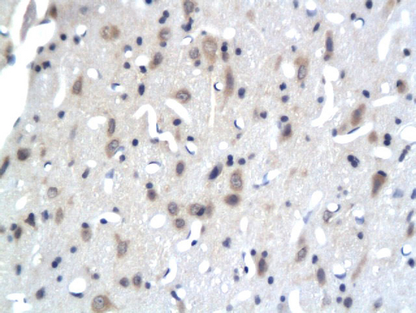 Formalin-fixed and paraffin embedded rat brain tissue labeled with Anti-PKC epsilon Polyclonal Antibody, Unconjugated (bs-2329R) followed by conjugation to the secondary antibody