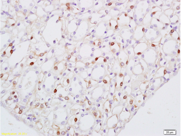 Formalin-fixed and paraffin embedded rat kidney tissue labeled with Anti-Cathepsin G Polyclonal Antibody, Unconjugated(bs-1598R) at 1:100 followed by conjugation to the secondary antibody, (SP-0023), and DAB staining