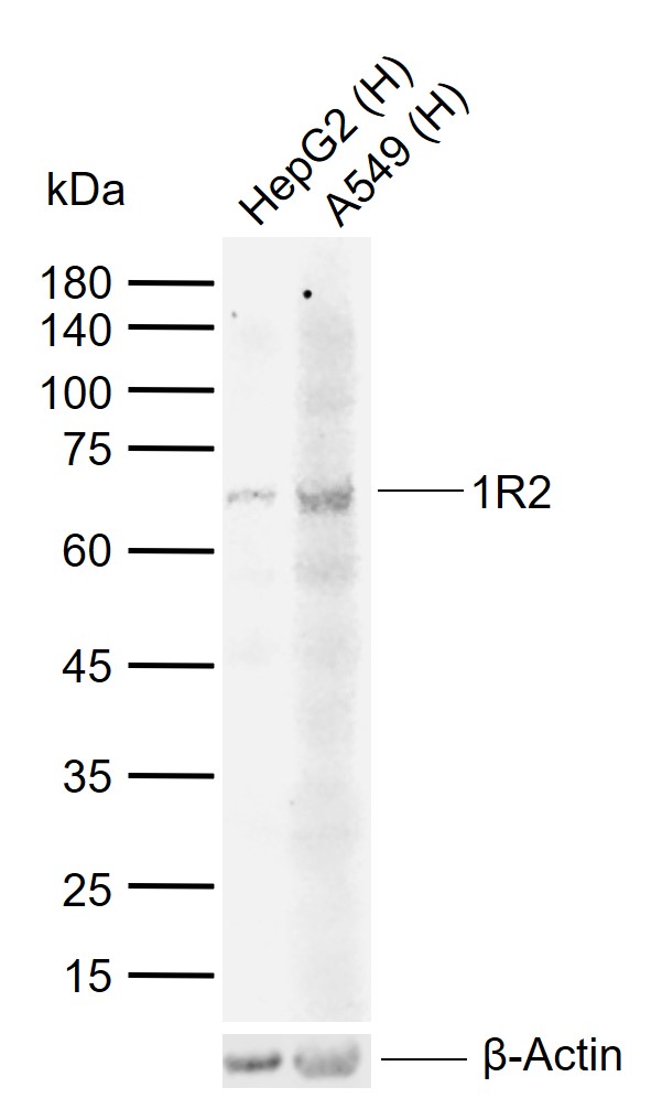Lane 1: Human HepG2 cell lysates; Lane 2: Human A549 cell lysates probed with 1R2 Polyclonal Antibody, Unconjugated (bs-2595R) at 1:1000 dilution and 4\u00b0C overnight incubation. Followed by conjugated secondary antibody incubation at 1:20000 for 60 min at 37˚C.