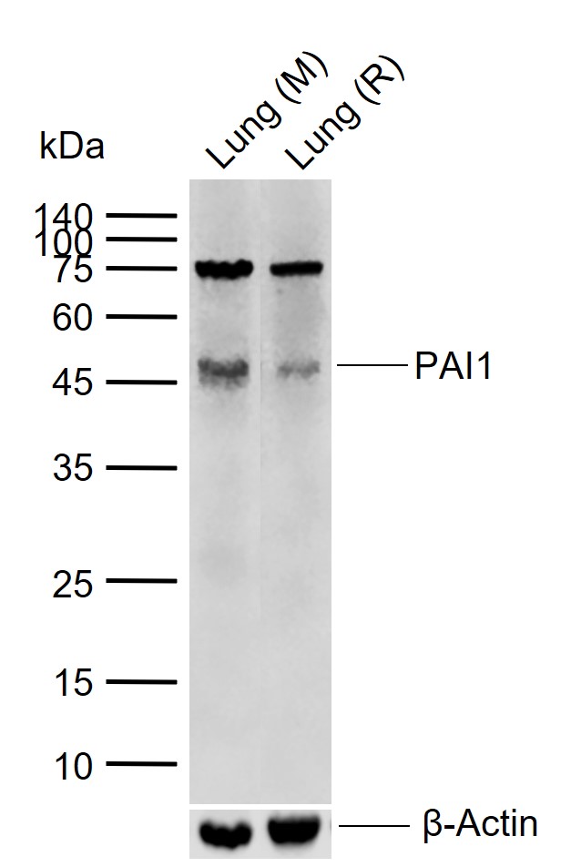 PAI-1 Polyclonal Antibody – Bioss