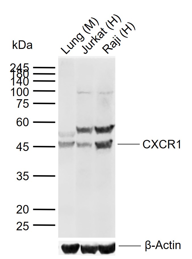 Lane 1: Mouse Lung tissue lysates; Lane 2: Human Jurkat cell lysates; Lane 3: Human Raji cell lysates probed with CXCR1 Polyclonal Antibody, Unconjugated (bs-1009R) at 1:1000 dilution and 4\u00b0C overnight incubation. Followed by conjugated secondary antibody incubation at 1:20000 for 60 min at 37˚C.