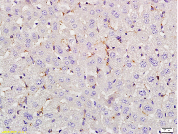 Formalin-fixed and paraffin embedded rat liver tissue labeled with Anti-LEF-1 Polyclonal Antibody, Unconjugated(bs-1843R) at 1:200 followed by conjugation to the secondary antibody, (SP-0023), and DAB staining Formalin-fixed and paraffin embedded rat liver tissue labeled with Anti-LEF-1 Polyclonal Antibody, Unconjugated(bs-1843R) at 1:200 followed by conjugation to the secondary antibody, (SP-0023), and DAB staining