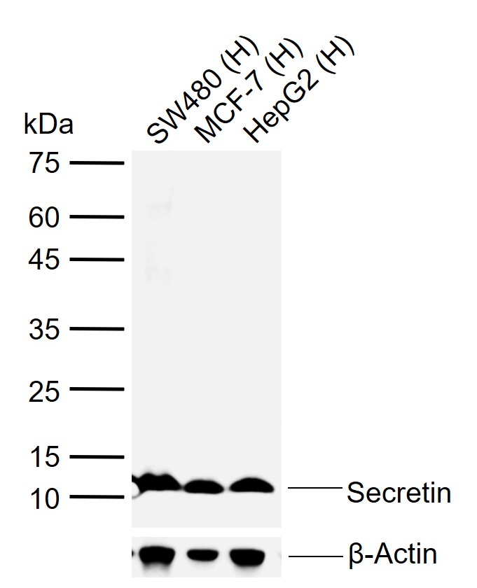 Lane 1: Human SW480 cell lysates; Lane 2: Human MCF-7 cell lysates; Lane 3: Human HepG2 cell lysates probed with Secretin Polyclonal Antibody, Unconjugated (bs-0088R) at 1:1000 dilution and 4\u00b0C overnight incubation. Followed by conjugated secondary antibody incubation at 1:20000 for 60 min at 37˚C.