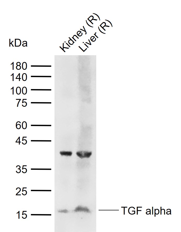 Lane 1: Rat Kidney tissue lysates; Lane 2: Rat Liver tissue lysates probed with TGF alpha Polyclonal Antibody, Unconjugated (bs-0066R) at 1:1000 dilution and 4\u00b0C overnight incubation. Followed by conjugated secondary antibody incubation at 1:20000 for 60 min at 37˚C.