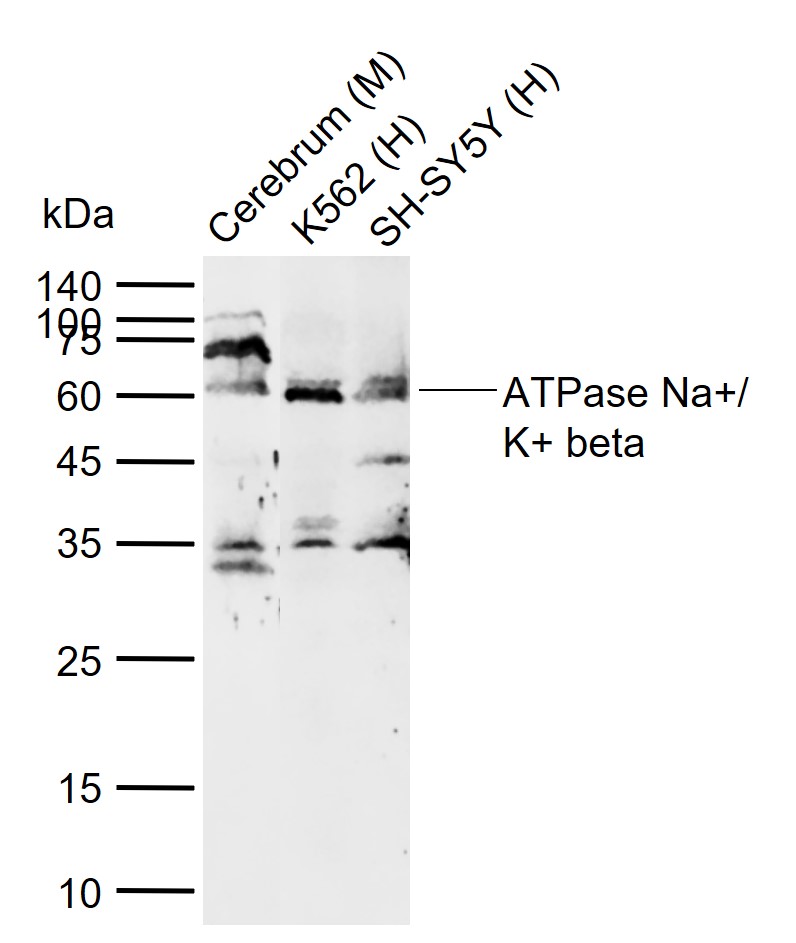 Lane 1: Mouse Cerebrum tissue lysates; Lane 2: Human K562 cell lysates; Lane 3: Human SH-SY5Y cell lysates probed with ATPase Na+\/ K+ beta 2 Polyclonal Antibody, Unconjugated (bs-1152R) at 1:1000 dilution and 4\u00b0C overnight incubation. Followed by conjugated secondary antibody incubation at 1:20000 for 60 min at 37˚C.