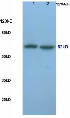L1 rat lung lysates, L2 rat brain lysates probed (bs-2930R) Anti-Frizzled-5 Polyclonal, Unconjugated at 1:200 in 4˚C. Followed by conjugation to secondary antibody (bs-0295G-HRP) at 1:3000 90min in 37˚C. Predicted band and observed band size: 62kD.