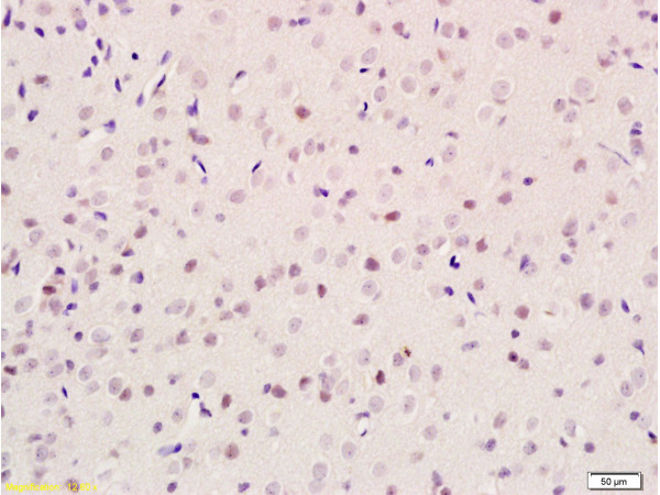 Formalin-fixed and paraffin embedded rat brain tissue labeled with Anti-GIG8/ID2 Polyclonal Antibody, Unconjugated (bs-3515R) at 1:100 followed by conjugation to the secondary antibody and DAB staining