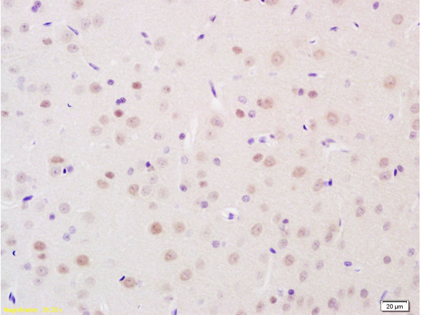 Formalin-fixed and paraffin embedded rat brain tissue labeled with Anti-BRN3A Polyclonal Antibody, Unconjugated(bs-3669R) at 1:100 followed by conjugation to the secondary antibody and DAB staining