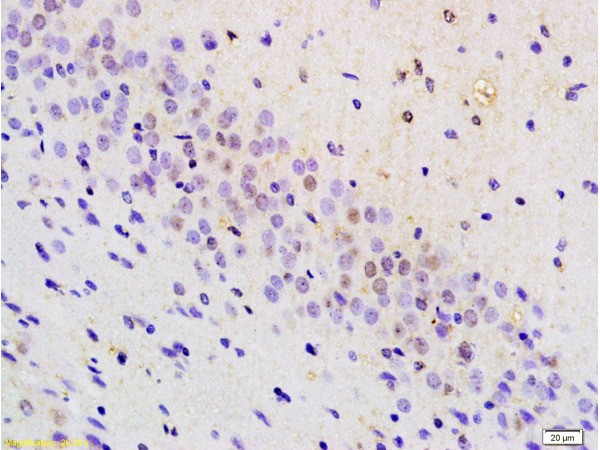 Formalin-fixed and paraffin embedded mouse brain tissue labeled with Anti-BRN3A Polyclonal Antibody, Unconjugated(bs-3669R) at 1:200 followed by conjugation to the secondary antibody and DAB staining