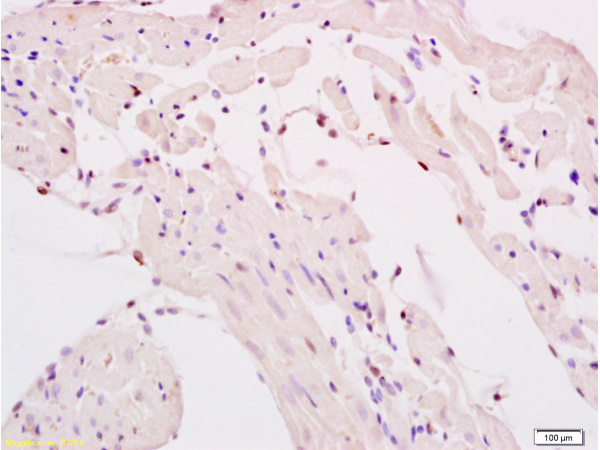 Formalin-fixed and paraffin embedded rat myocardium tissue labeled with Anti-SMURF2 Polyclonal Antibody, Unconjugated(bs-4056R) at 1:200 followed by conjugation to the secondary antibody and DAB staining