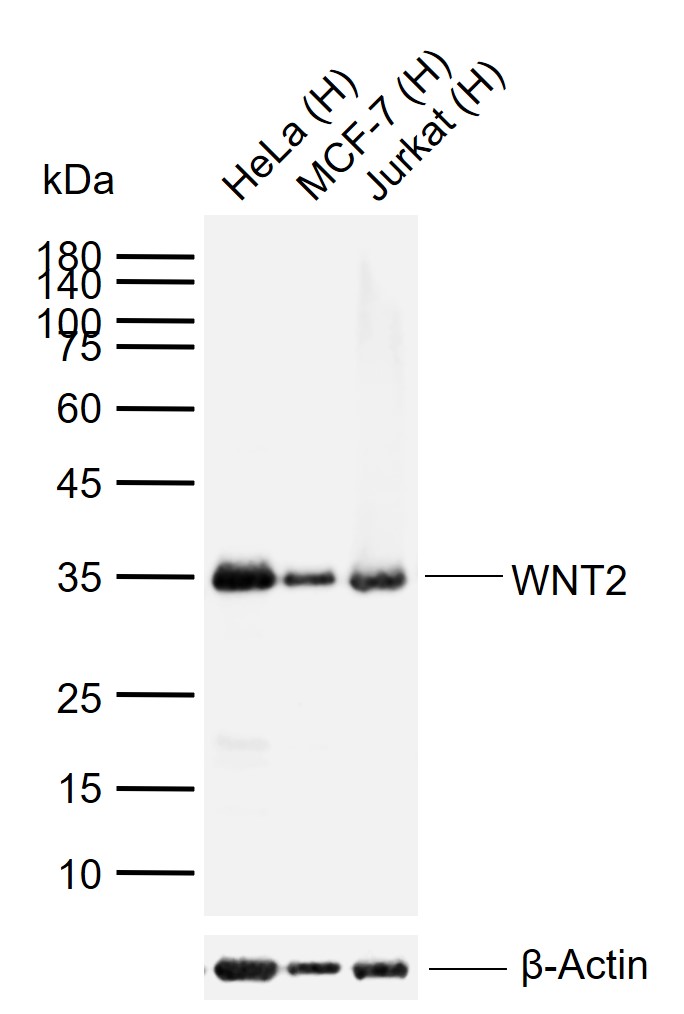 Lane 1: Human HeLa cell lysates; Lane 2: Human MCF-7 cell lysates; Lane 3: Human Jurkat cell lysates probed with WNT2 Polyclonal Antibody, Unconjugated (bs-6133R) at 1:1000 dilution and 4\u00b0C overnight incubation. Followed by conjugated secondary antibody incubation at 1:20000 for 60 min at 37˚C.