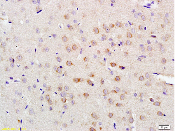 Formalin-fixed and paraffin embedded rat brain tissue labeled with Anti-LLGL1/2 Polyclonal Antibody, Unconjugated (bs-6069R) at 1:200 followed by conjugation to the secondary antibody and DAB staining