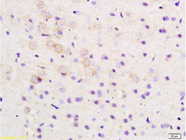 Formalin-fixed and paraffin embedded rat brain tissue labeled with Anti-ARHGAP32 Polyclonal Antibody, Unconjugated (bs-9296R) at 1:200 followed by conjugation to the secondary antibody and DAB staining
