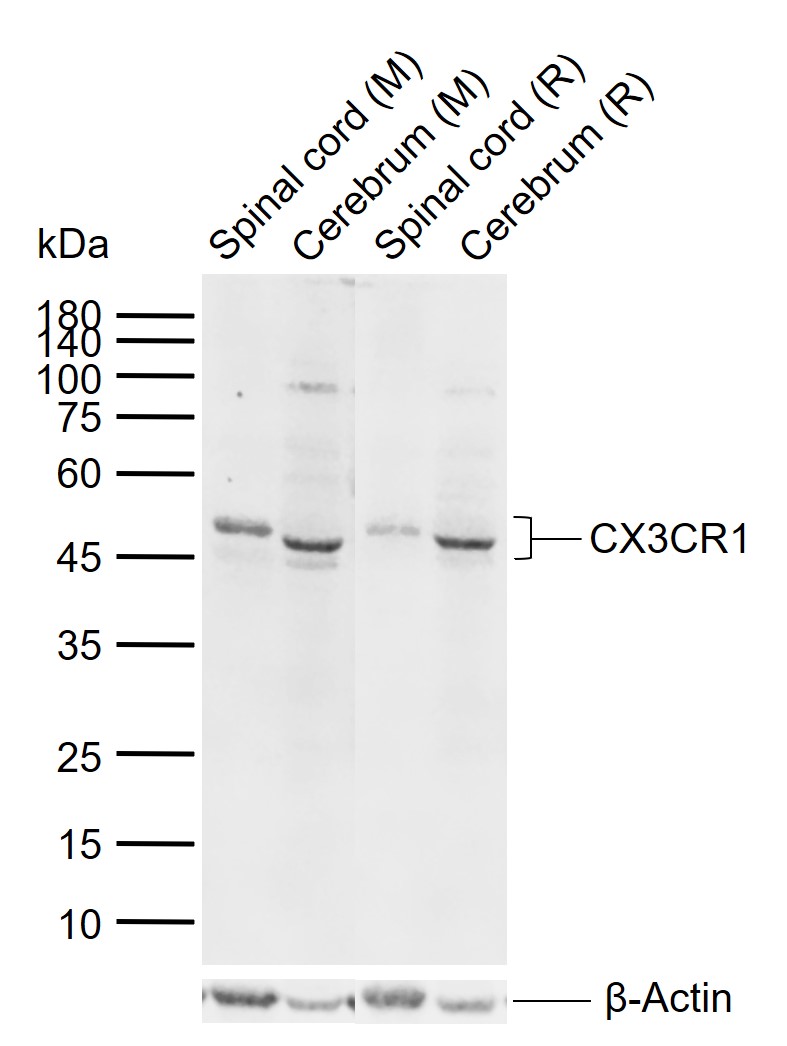 Lane 1: Mouse Spinal cord tissue lysates; Lane 2: Mouse Cerebrum tissue lysates; Lane 3: Rat Spinal cord tissue lysates; Lane 4: Rat Cerebrum tissue lysates probed with CX3CR1 Polyclonal Antibody, Unconjugated (bs-1728R) at 1:1000 dilution and 4\u00b0C overnight incubation. Followed by conjugated secondary antibody incubation at 1:20000 for 60 min at 37˚C.