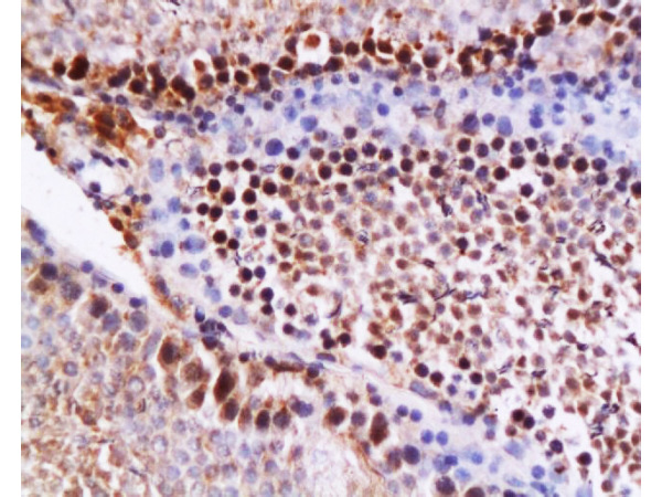 Formalin-fixed and paraffin embedded rat testis tissue (high fat) labeled with Anti-NPY\/Neuropeptide Y Polyclonal Antibody, Unconjugated (bs-1105R) at 1:200 followed by conjugation to the secondary antibody and DAB staining