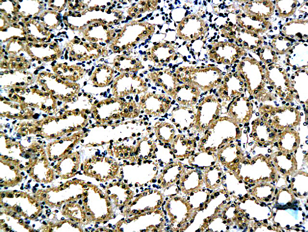 Formalin-fixed and paraffin embedded rat kidney tissue labeled with Anti-Laminin alpha 5 Polyclonal Antibody, Unconjugated (bs-1086R) followed by conjugation to the secondary antibody and DAB staining