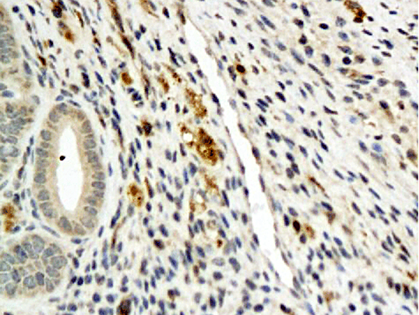 Formalin-fixed and paraffin embedded mouse ovary labeled with Anti-ANGPT3/ANG3/ANGPT4/ANG4 Polyclonal Antibody, Unconjugated (bs-1087R) followed by conjugation to the secondary antibody and DAB staining